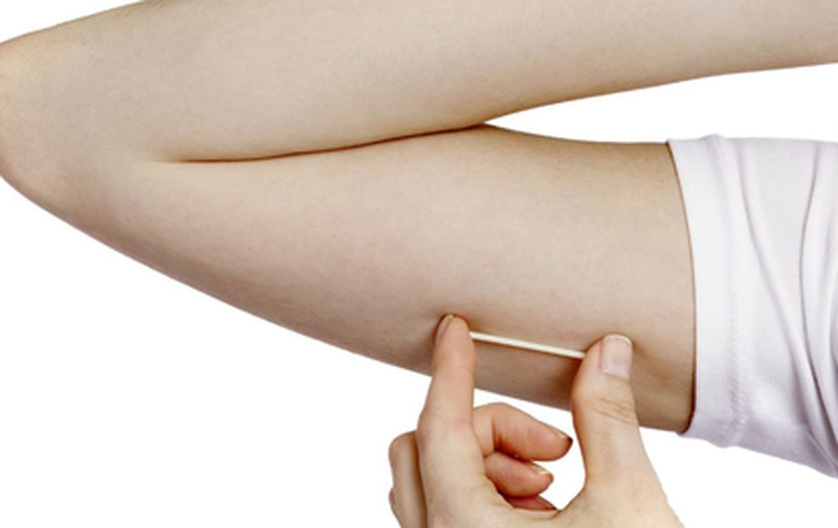 Médica da Afya explica vantagens e contraindicações do implante subdérmico contraceptivo, que será adotado no SUS