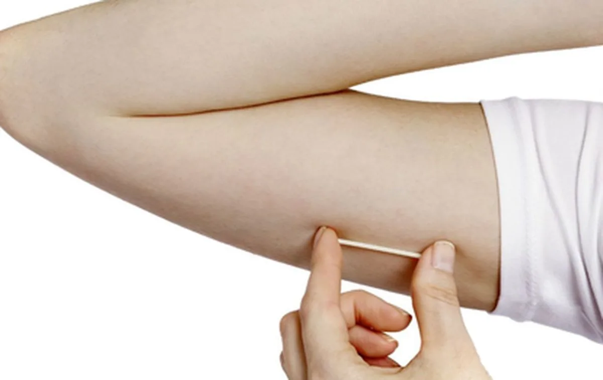 Médica da Afya explica vantagens e contraindicações do implante subdérmico contraceptivo, que será adotado no SUS