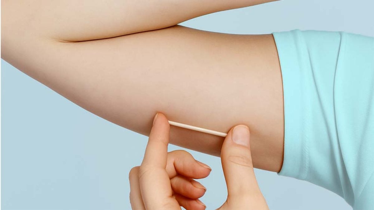 Manaus vai ofertar implante contraceptivo de longa duração em 11 unidades de saúde a partir de 2026