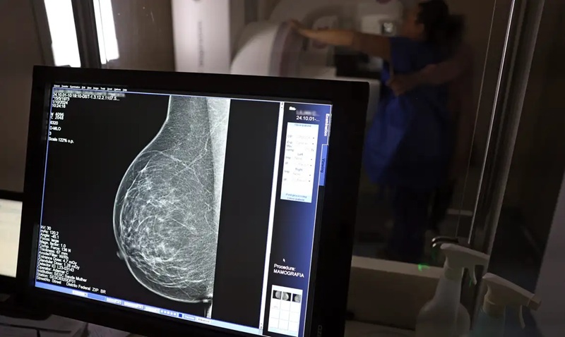 Outubro Rosa 2026 destaca prevenção e controle do câncer entre mulheres negras